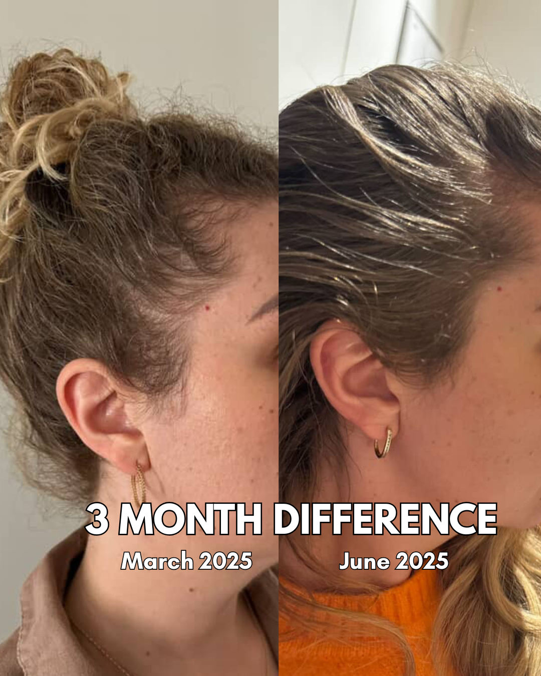 Bloom Hair Vitality Oil - 50ml