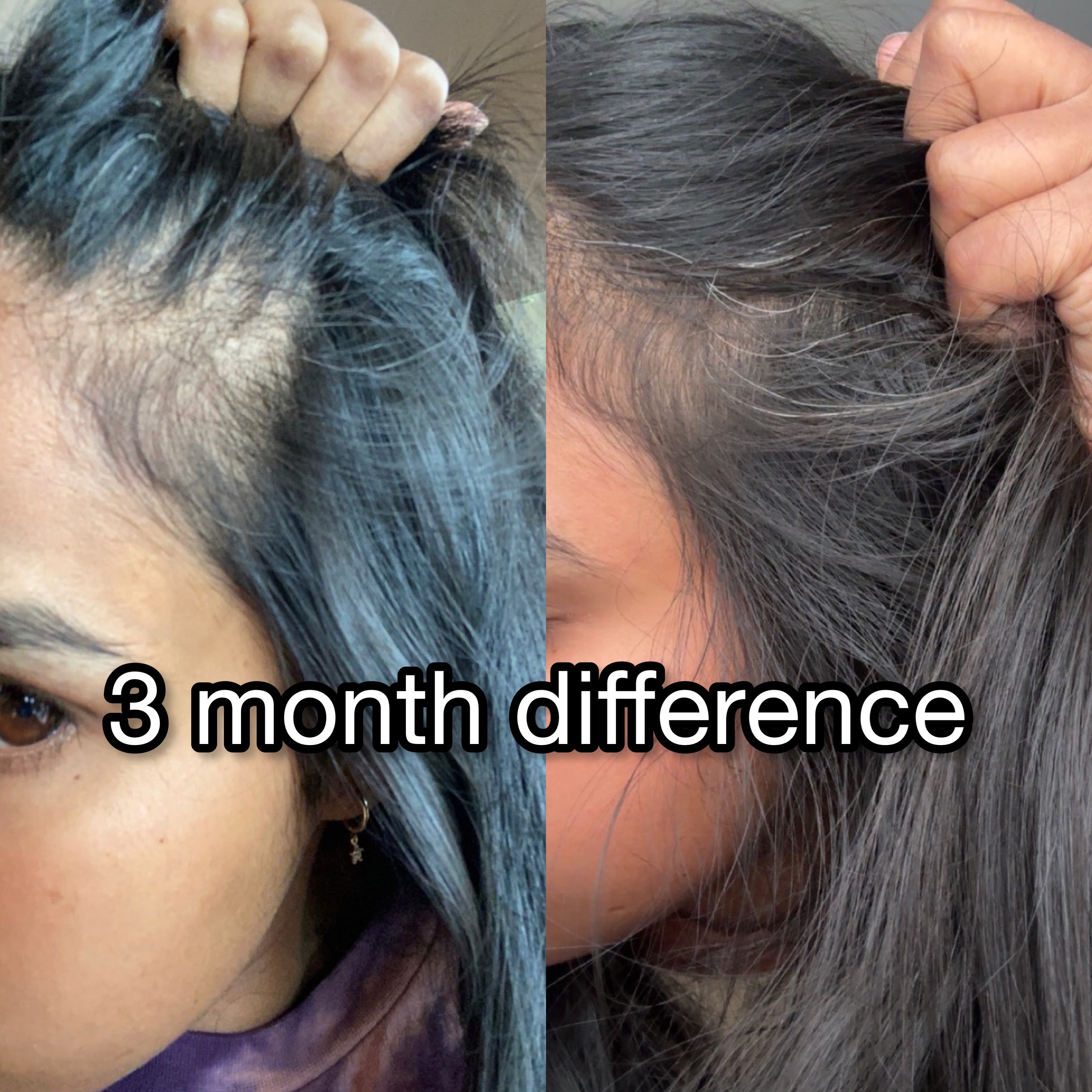 Bloom Hair Vitality Oil - 50ml + FREE Acetate Comb