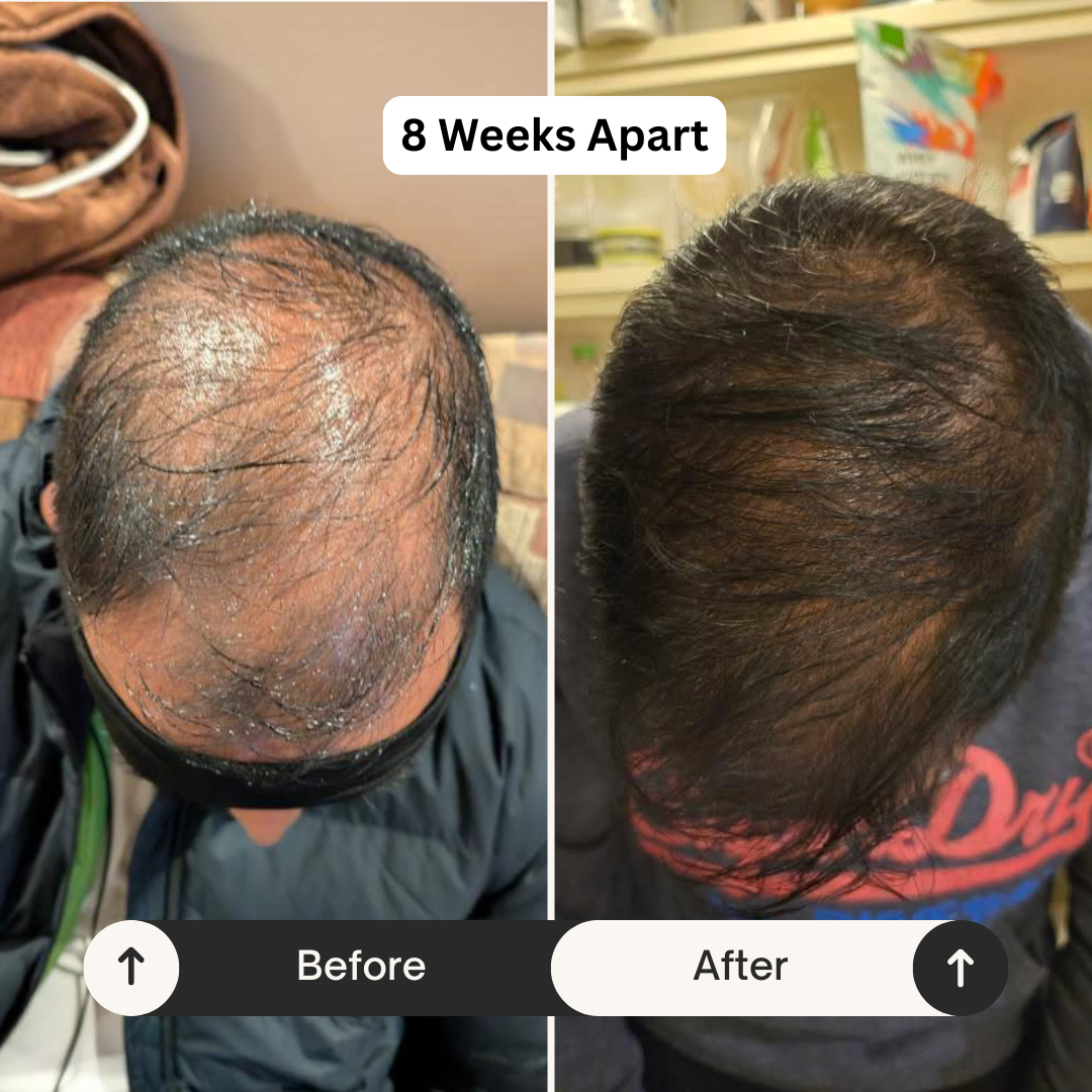 Bloom Hair Vitality Oil - 50ml