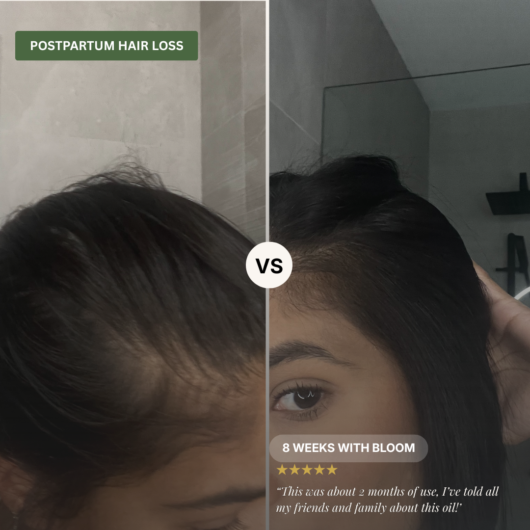 Bloom Hair Vitality Oil - 50ml [PRE-ORDER]