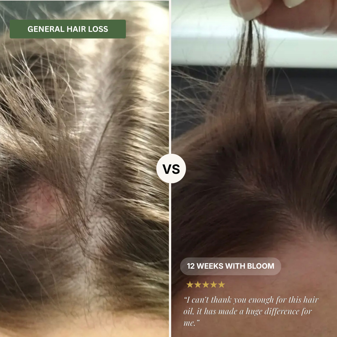 Bloom Hair Vitality Oil - 50ml [PRE-ORDER]