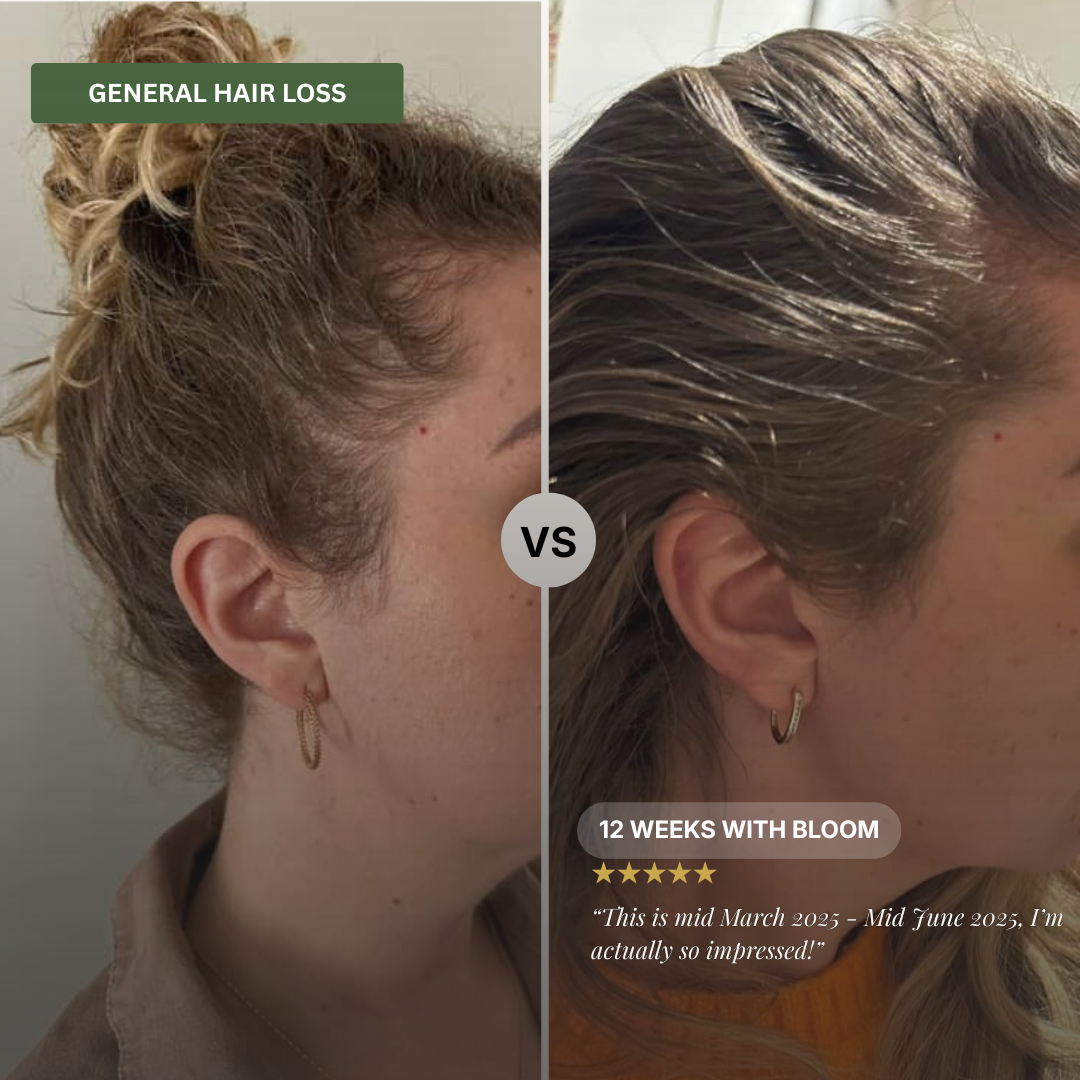 Bloom Hair Vitality Oil - 50ml [PRE-ORDER]