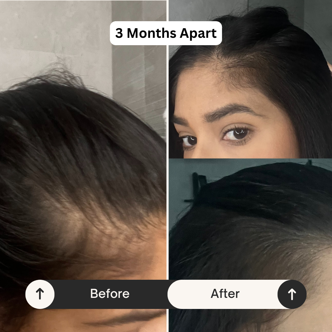 Bloom Hair Vitality Oil - 50ml