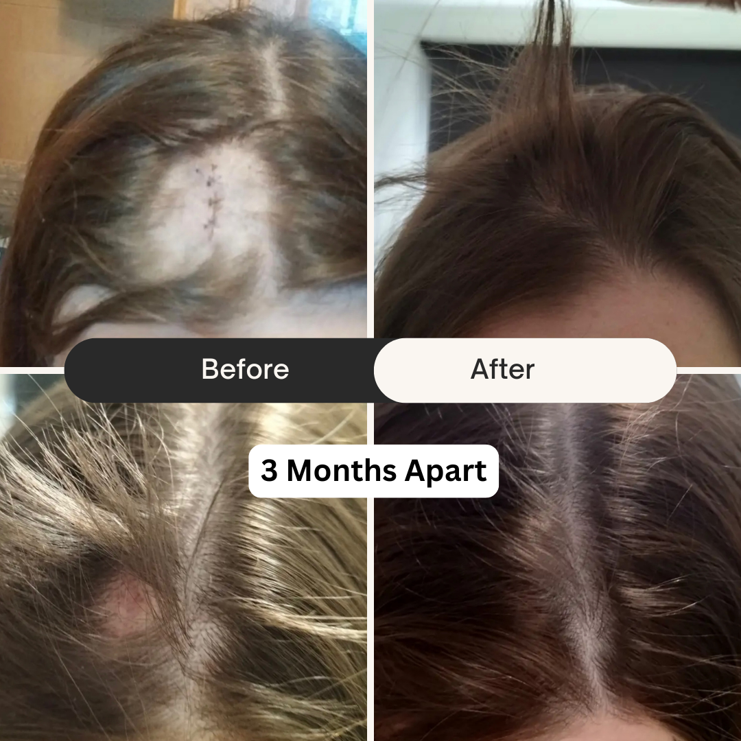 Bloom Hair Vitality Oil - 50ml